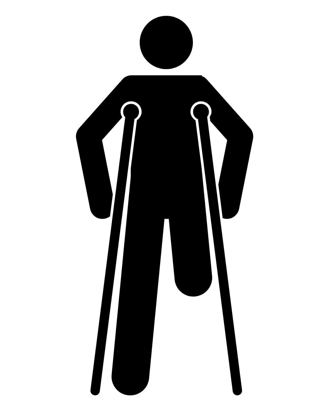 Amputation management
